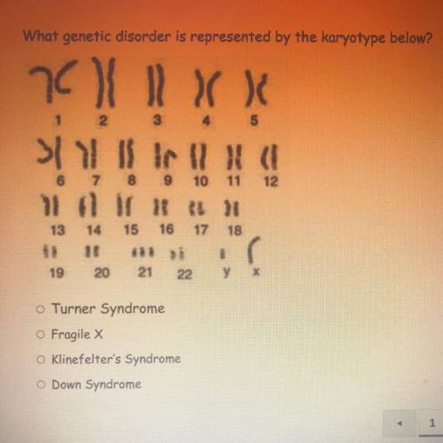 What genetic disorder is represented by the karyotype below?
pls help