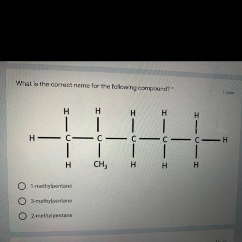 What is the correct name