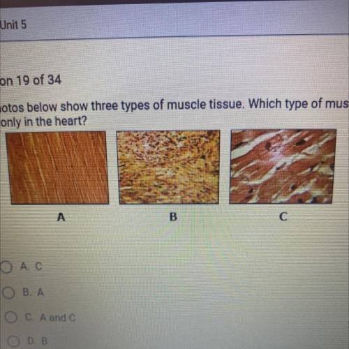 The photos below show three types of muscle tissue. Which type of muscle is

found only in the hea