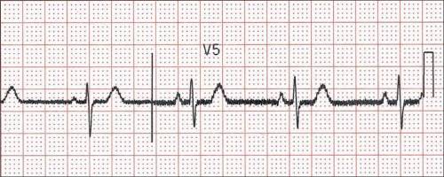 What name is this ekg