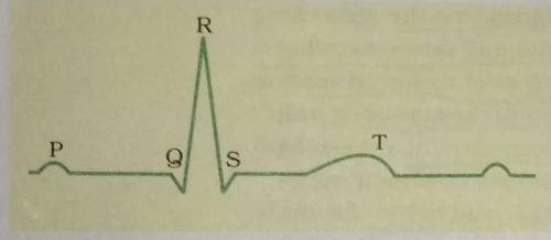 What does the QRS complex represents as??​