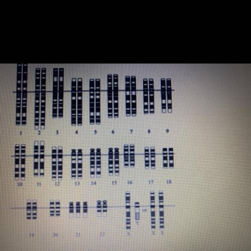 Use the following Karyotype to identify any genetic abnormalities in the subject.

A. Inversion mu
