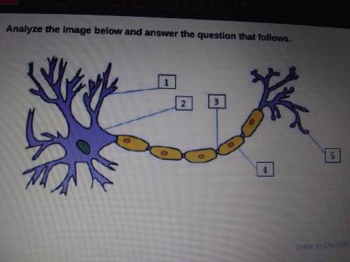 1.) Which line is pointing to the axon terminals?

2.) Which line is pointing to the cell body?
3.