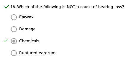Which of the following is NOT a cause of hearing loss?