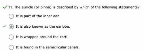 The auricle (or pinna) is described by which of the following statements?