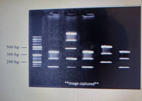How many base pairs long are the E. coli O157:H7 DNA fragments that were separated out on the gel?
