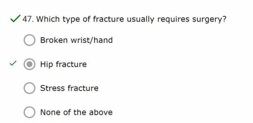Which type of fracture usually requires surgery?
*Hip fracture correct