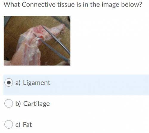 What Connective tissue is in the image below?