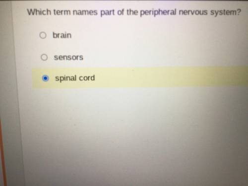 Which term names part of the peripheral nervous system?

I have another question which organism ha