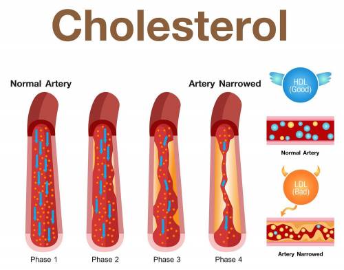 Cholesterol is needed to build call membrane.what is cholesterol