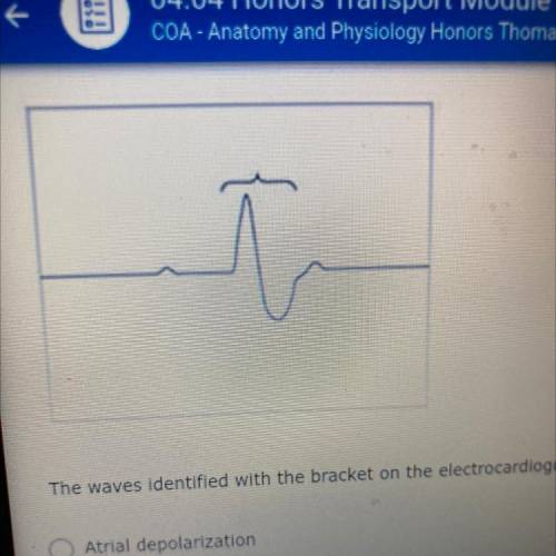 The wave identified with the bracket on the electrocardiography correspond to which event atrial de