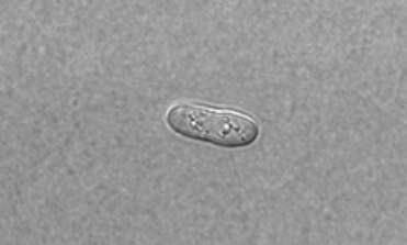 The photo shows one yeast cell. This cell makes up the entire organism.

Which two processes will