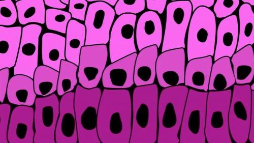 Fill in the blank: The picture shows you many skin cells working together to form epithelial ______