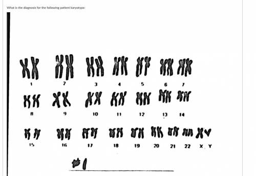The question in screenshot what karyotype?