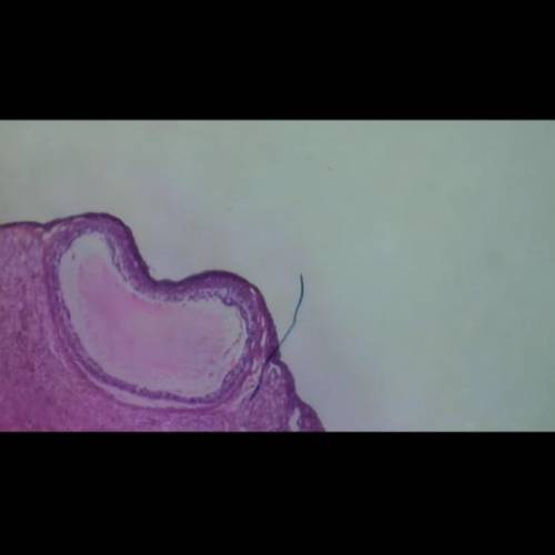 What is the blue line on this ovary of sec microscope slide?